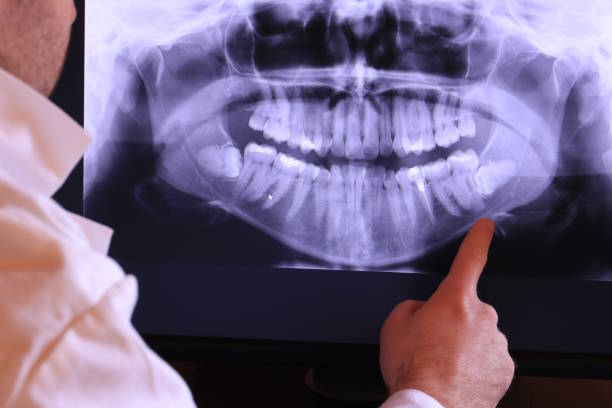 Best Urgent Care for Lost Fillings or Crowns in Elizabeth Lake, CA